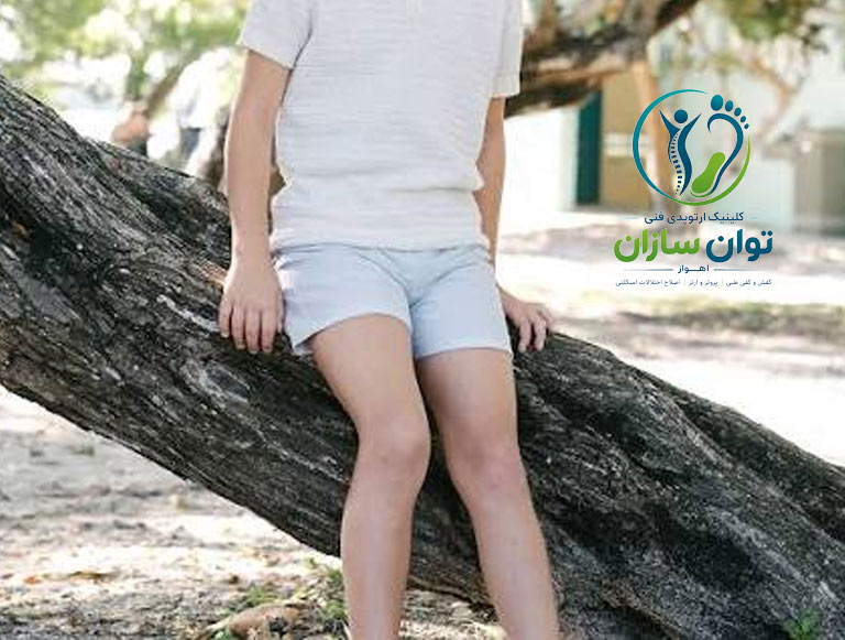 کوتاهی پا در اهواز