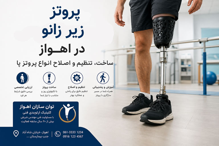 پروتز زیر زانو در اهواز