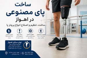 ساخت پای مصنوعی در اهواز